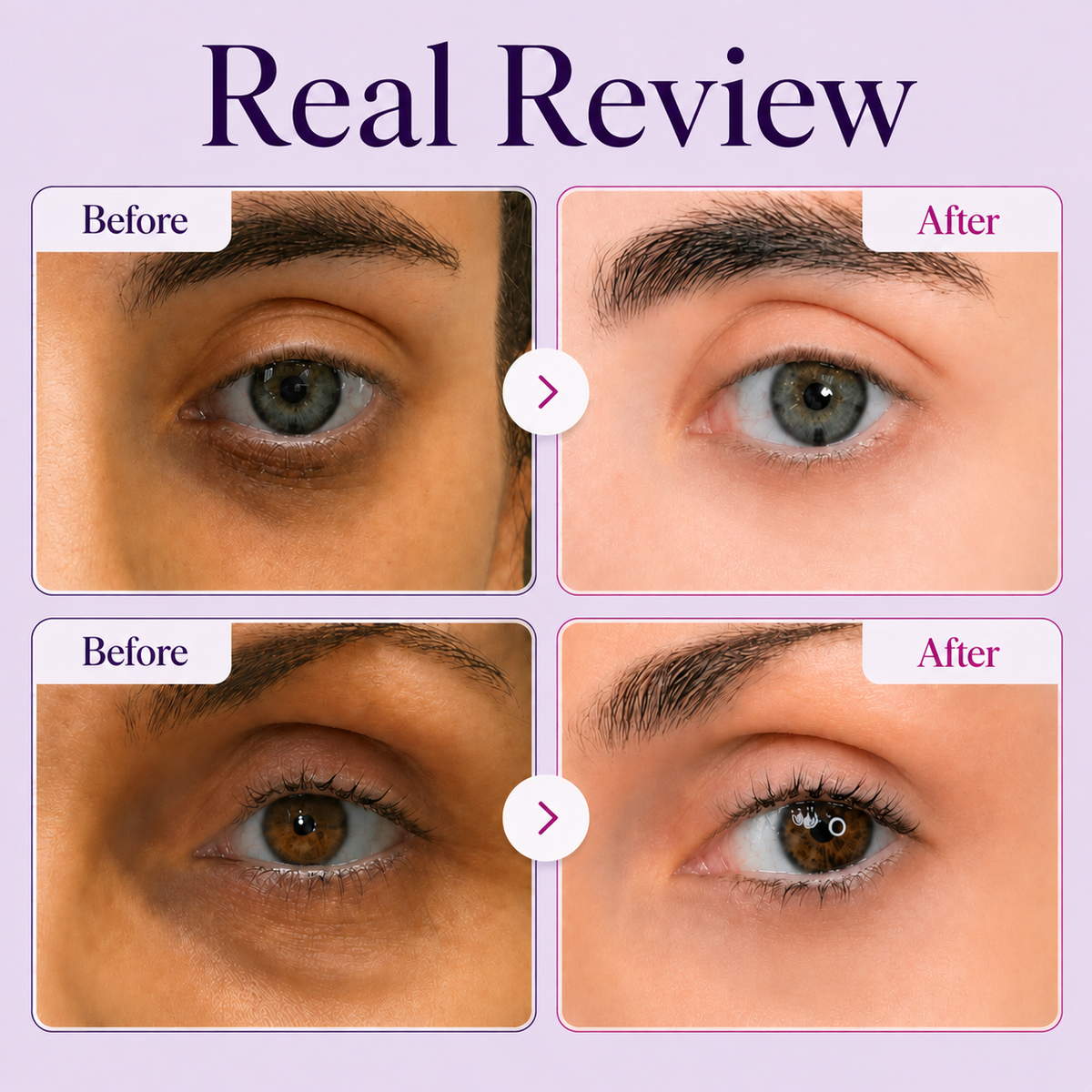 LOVILDS™ Calcium Peptide Eye Cream