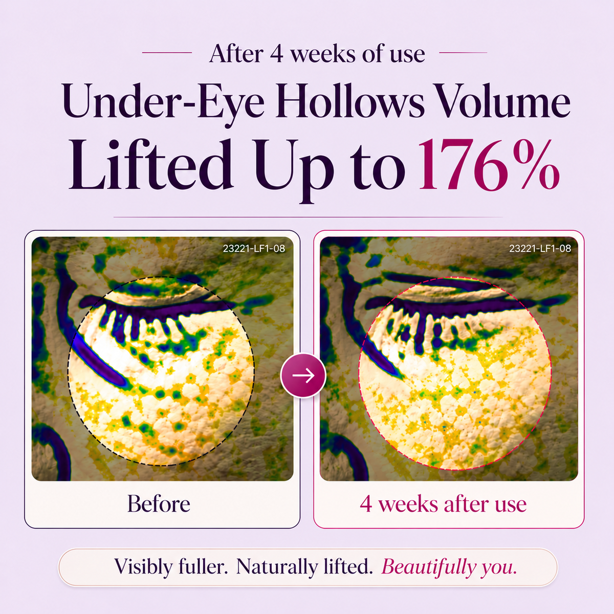 LOVILDS™ Calcium Peptide Eye Cream