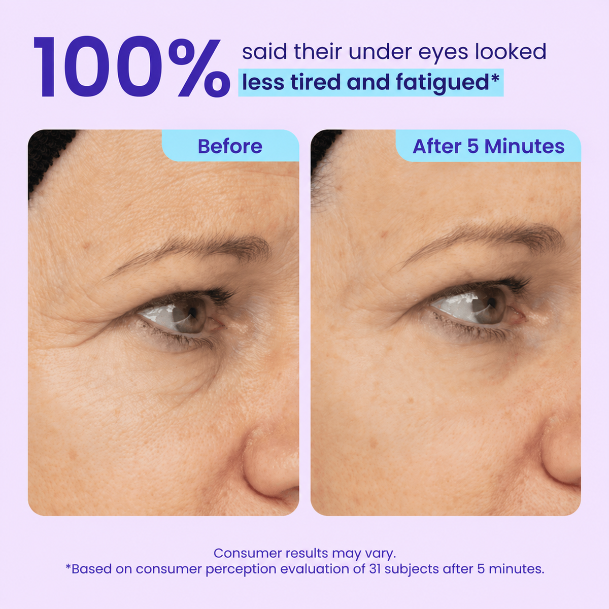 LOVILDS™ 3-in-1 Instant Lift Eye Gel  （upsel）l