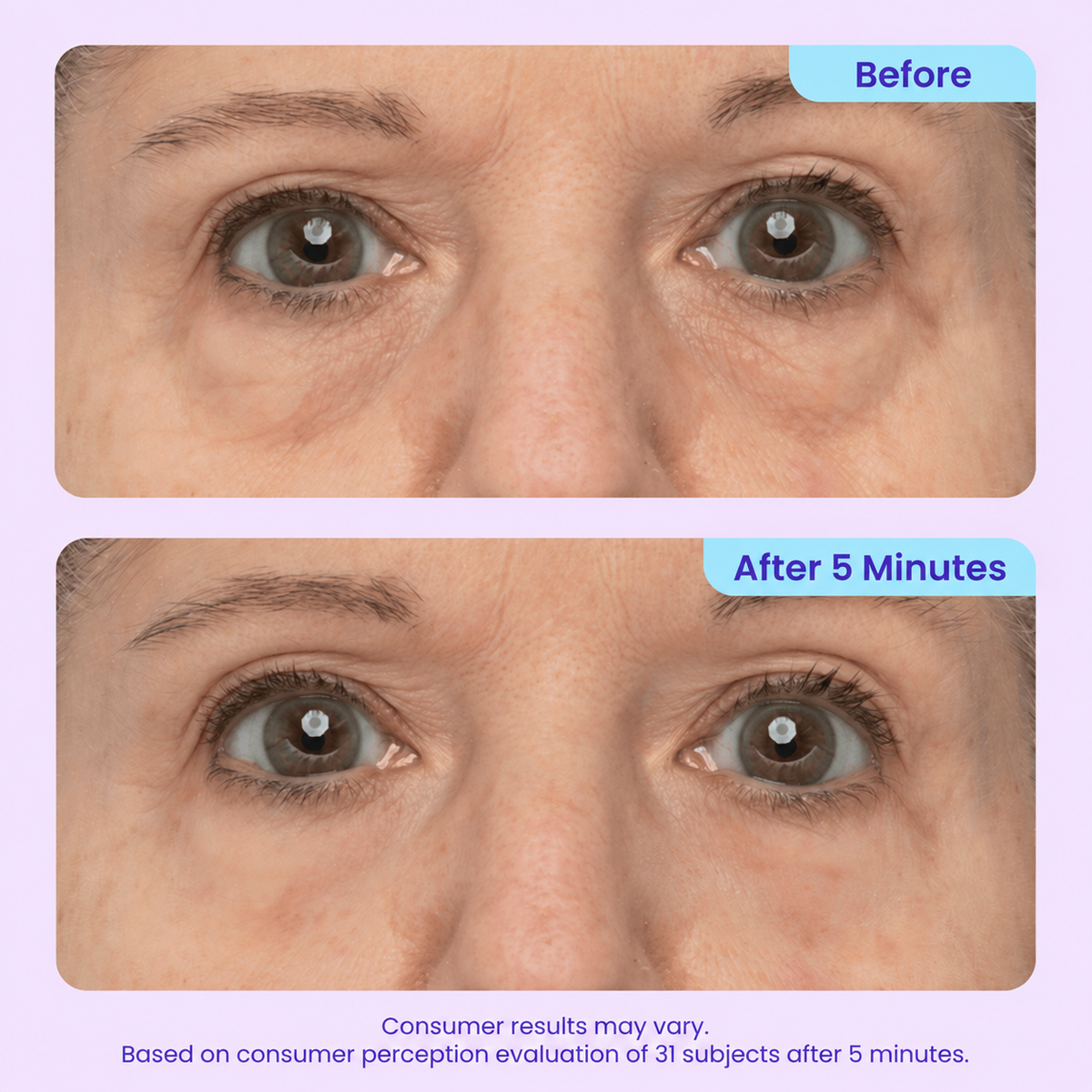 LOVILDS™ 3-in-1 Instant Lift Eye Gel  （upsel）l